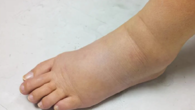 Photo of पैरों में सूजन की समस्या से निजात पाने के लिए अपनाए ये  घरेलू उपचार