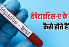 Photo of बारिश के मौसम में क्यों बढ़ जाता है हेपेटाइटिस-ए का खतरा? 