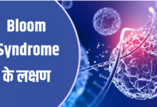 Photo of 6 तरह के कैंसर का कारण बन सकता है Bloom Syndrome