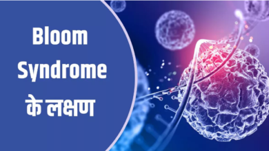 Photo of 6 तरह के कैंसर का कारण बन सकता है Bloom Syndrome