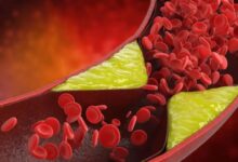Photo of जीन थेरेपी से खराब कोलेस्ट्रॉल में आई कमी जाने