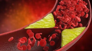 Photo of जीन थेरेपी से खराब कोलेस्ट्रॉल में आई कमी जाने