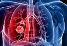 Photo of वायु प्रदूषण बढ़ा रहा कैंसर का खतरा, जाने कैसे