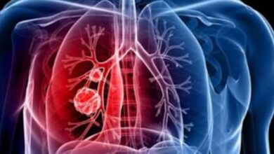 Photo of वायु प्रदूषण बढ़ा रहा कैंसर का खतरा, जाने कैसे