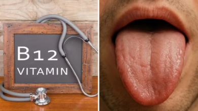 Photo of जीभ पर दिखते हैं विटामिन-B12 की कमी के 3 बड़े संकेत