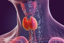 Photo of थायराइड रोगी भूलकर भी न करें इन चार चीजों का सेवन