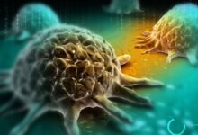 Photo of कैंसर के शुरुआत में नजर आते हैं ये 5 लक्षण