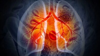 Photo of फेफड़ों के कैंसर के खिलाफ बड़ी कामयाबी! जाने केसे
