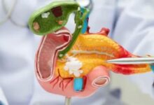 Photo of क्यों नहीं पहचान आते पैंक्रियाटिक कैंसर के लक्षण? जाने