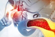 Photo of सीने में हल्के दर्द के साथ दिख रहे हैं ये चार लक्षण