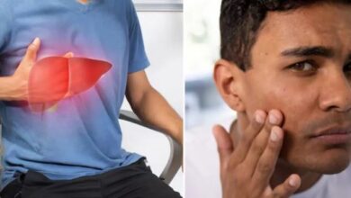 Photo of त्वचा पर नजर आते हैं लिवर की खराबी के 5 लक्षण