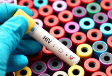 Photo of दिल्ली में एचआईवी के 60 हजार मरीज, राष्ट्रीय औसत से अधिक है राजधानी में प्रसार दर; पुरुषों की संख्या अधिक