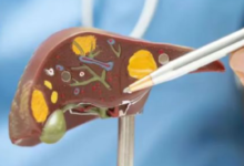 Photo of ज्यादा तला-भुना और फैटी खाना बन सकता है लिवर कैंसर की वजह