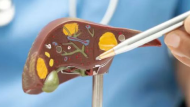 Photo of ज्यादा तला-भुना और फैटी खाना बन सकता है लिवर कैंसर की वजह