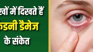 Photo of किडनी खराब होने से पहले आंखें देती हैं 6 संकेत