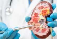 Photo of किडनी डिजीज को साइलेंट किलर क्यों कहा जाता है?