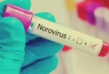 Photo of हंटावायरस के बाद Norovirus की एंट्री, फ्रांस में क्रूज शिप पर पेट संक्रमण का खतरा